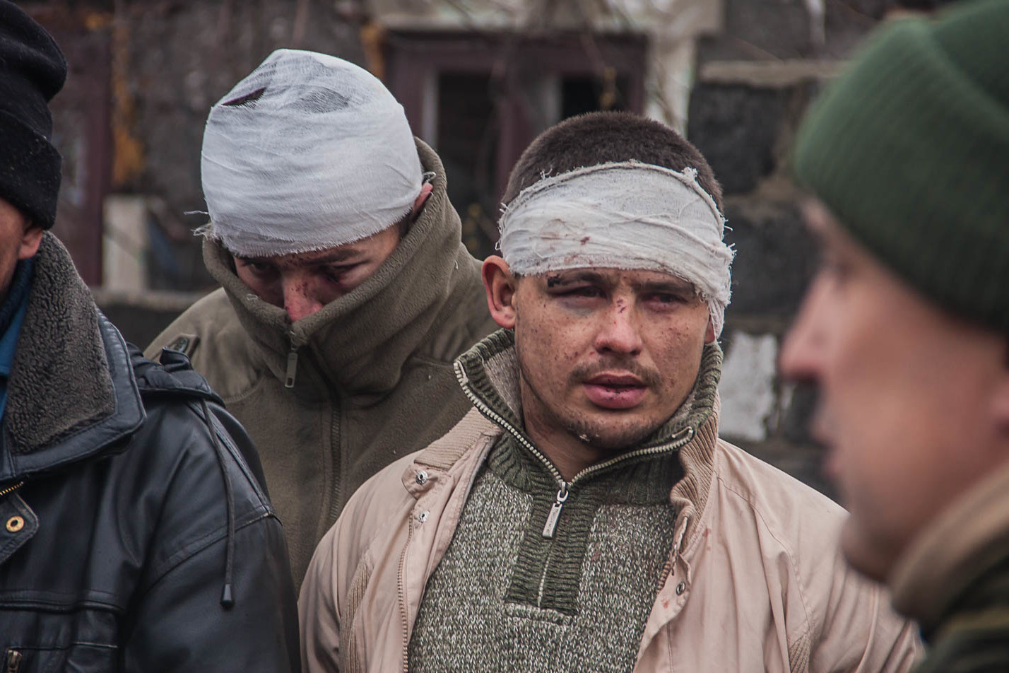 Пленные украинцы в плену. Военнопленные на Украине.