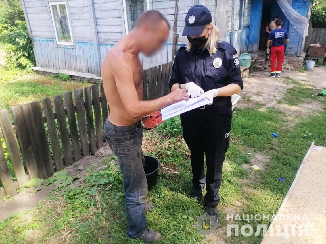 На Чернігівщині чоловік облив бензином і підпалив власну дружину (Фото)